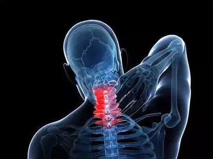 When cervical spondylosis meet you, will